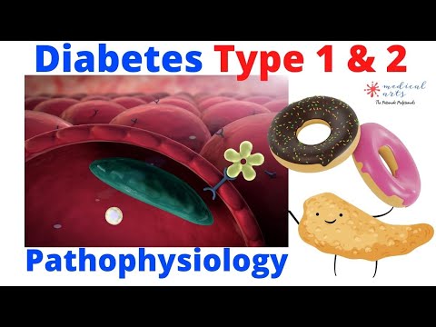 Type 1 vs Type 2 Diabetes: Pathophysiology Explained | Medical Arts video thumbnail