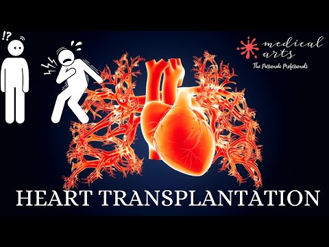 Heart Transplantation: How a Donor Heart Replaces a Failing Heart | Medical Arts video thumbnail