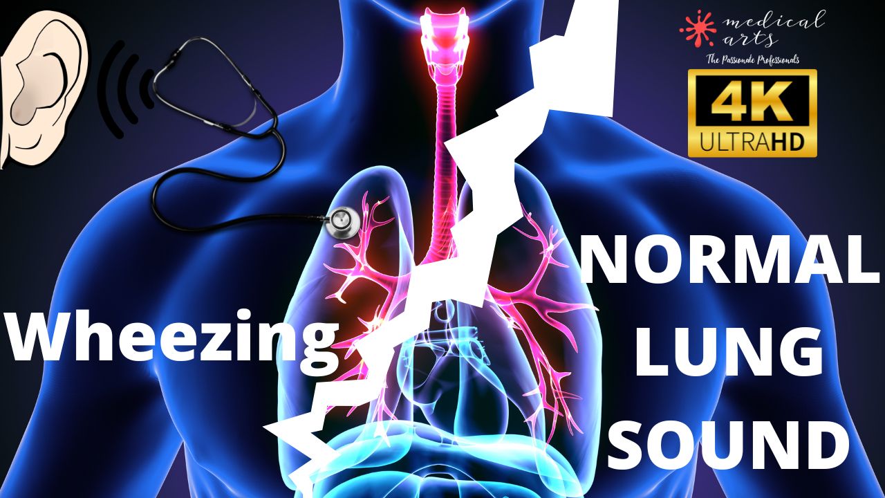 compare lung sounds - Normal Breath Sound vs Adventitious Sound - Expiratory Wheezing.