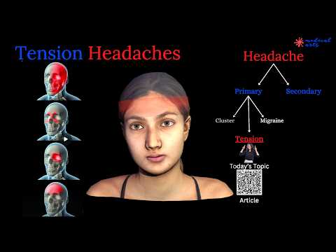 Headaches Explained: Types and Mechanisms video thumbnail