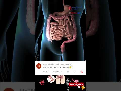 Appendicitis Explained: Anatomy, Inflammation and Treatment | Medical Arts video thumbnail