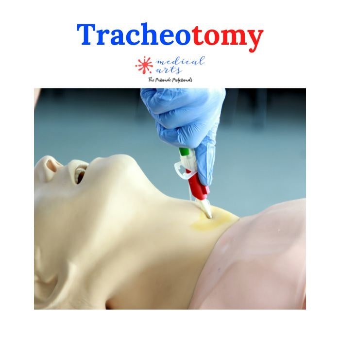 Tracheostomy, tracheotomy procedure explained & 3D video
