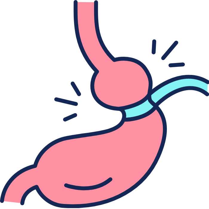 Weight Loss Surgery | Gastric Band | Lap-Band