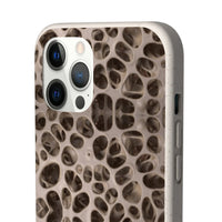 Biodegradable Phone Cases - Microscopic Bones Tissue - Medical Design - Medical Arts Shop