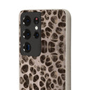 Biodegradable Phone Cases - Microscopic Bones Tissue - Medical Design - Medical Arts Shop