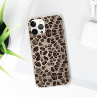 Biodegradable Phone Cases - Microscopic Bones Tissue - Medical Design - Medical Arts Shop
