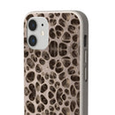 Biodegradable Phone Cases - Microscopic Bones Tissue - Medical Design - Medical Arts Shop