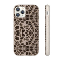 Biodegradable Phone Cases - Microscopic Bones Tissue - Medical Design - Medical Arts Shop