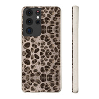 Biodegradable Phone Cases - Microscopic Bones Tissue - Medical Design - Medical Arts Shop