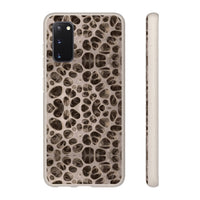 Biodegradable Phone Cases - Microscopic Bones Tissue - Medical Design - Medical Arts Shop