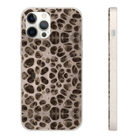 Biodegradable Phone Cases - Microscopic Bones Tissue - Medical Design - Medical Arts Shop