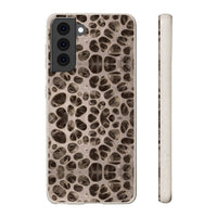 Biodegradable Phone Cases - Microscopic Bones Tissue - Medical Design - Medical Arts Shop