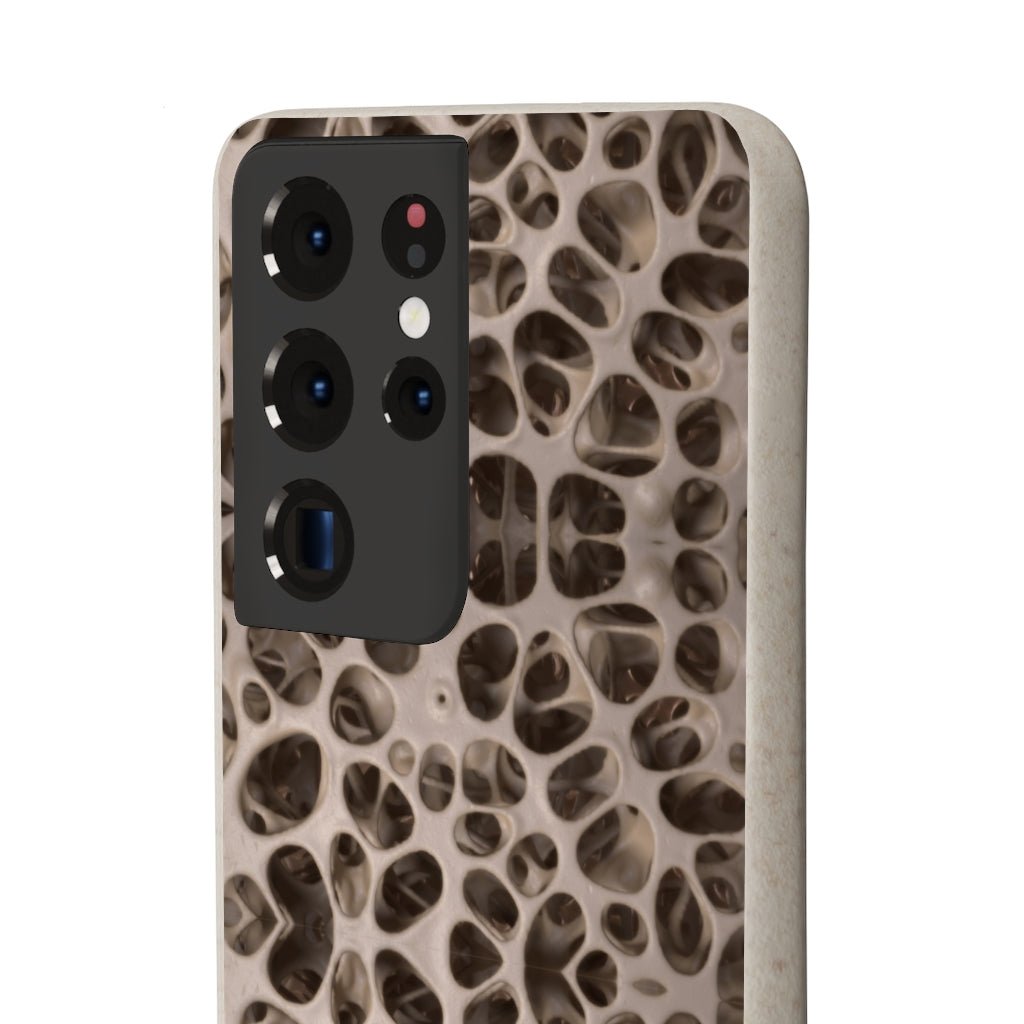 Biodegradable Phone Cases - Microscopic Bones Tissue - Medical Design - Medical Arts Shop