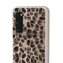Biodegradable Phone Cases - Microscopic Bones Tissue - Medical Design - Medical Arts Shop