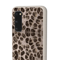 Biodegradable Phone Cases - Microscopic Bones Tissue - Medical Design - Medical Arts Shop