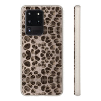 Biodegradable Phone Cases - Microscopic Bones Tissue - Medical Design - Medical Arts Shop