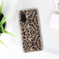 Biodegradable Phone Cases - Microscopic Bones Tissue - Medical Design - Medical Arts Shop