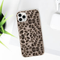 Biodegradable Phone Cases - Microscopic Bones Tissue - Medical Design - Medical Arts Shop