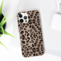 Biodegradable Phone Cases - Microscopic Bones Tissue - Medical Design - Medical Arts Shop
