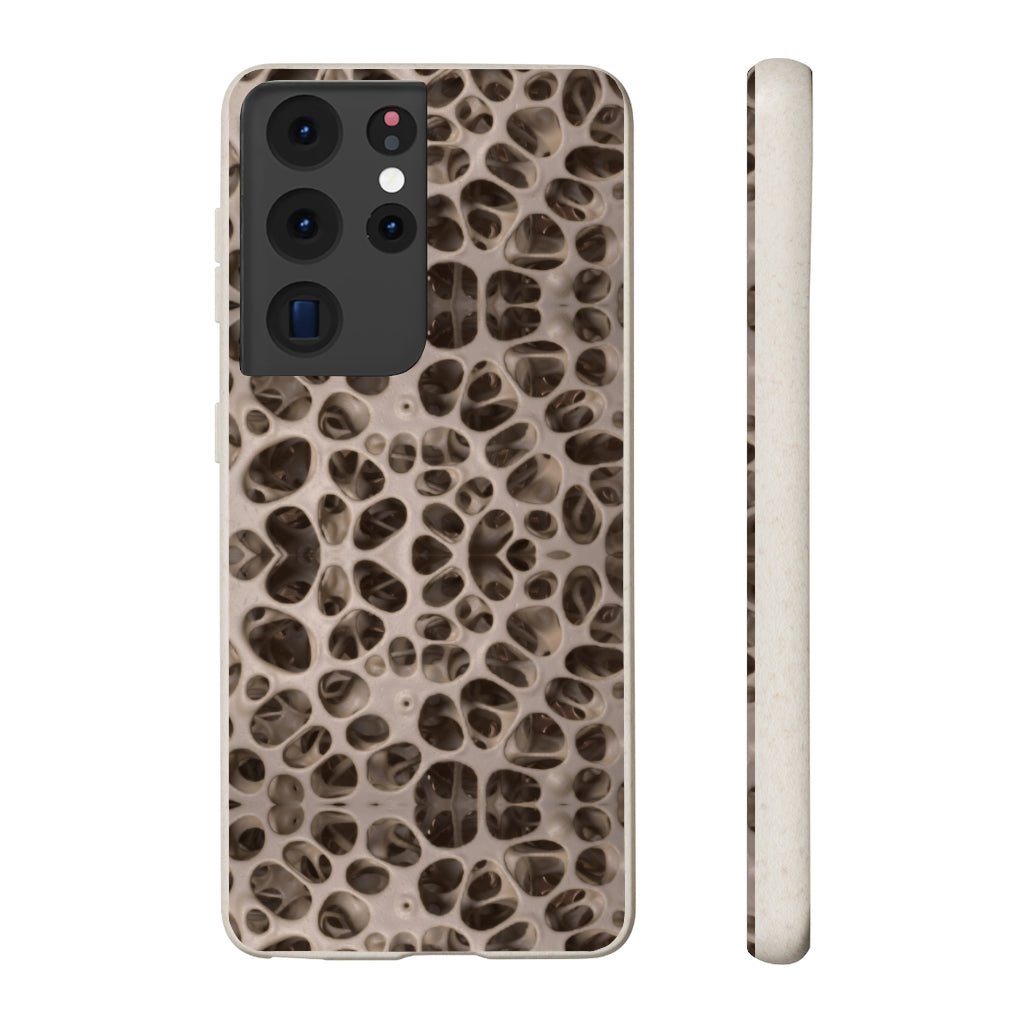 Biodegradable Phone Cases - Microscopic Bones Tissue - Medical Design - Medical Arts Shop