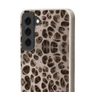 Biodegradable Phone Cases - Microscopic Bones Tissue - Medical Design - Medical Arts Shop