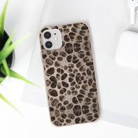 Biodegradable Phone Cases - Microscopic Bones Tissue - Medical Design - Medical Arts Shop