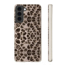 Biodegradable Phone Cases - Microscopic Bones Tissue - Medical Design - Medical Arts Shop