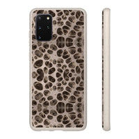 Biodegradable Phone Cases - Microscopic Bones Tissue - Medical Design - Medical Arts Shop