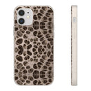 Biodegradable Phone Cases - Microscopic Bones Tissue - Medical Design - Medical Arts Shop