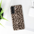 Biodegradable Phone Cases - Microscopic Bones Tissue - Medical Design - Medical Arts Shop