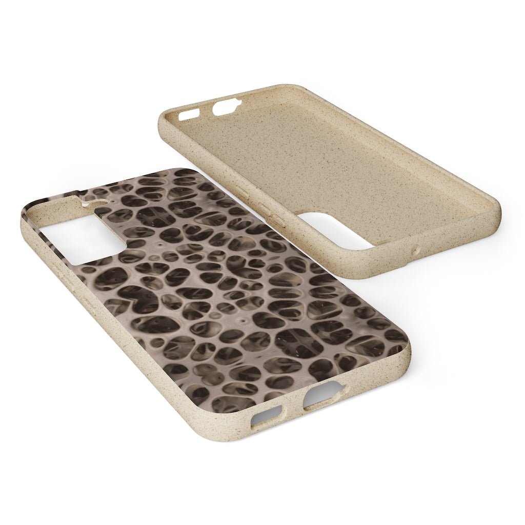 Biodegradable Phone Cases - Microscopic Bones Tissue - Medical Design - Medical Arts Shop