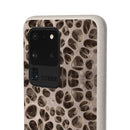 Biodegradable Phone Cases - Microscopic Bones Tissue - Medical Design - Medical Arts Shop